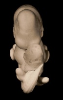 Front view of the embryo prior to sectioning