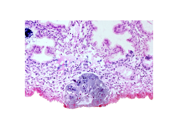blastocystic cavity (blastocoele), embryonic disc, membranous trophoblast at abembryonic pole, solid syncytiotrophoblast