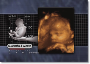 6 Six Month 3 weeks Fetus, 3D Ultrasound