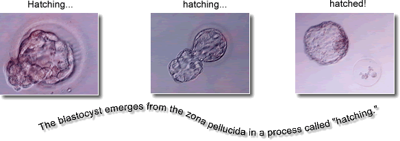 The blastocyst emerges from the zona pellucida in a process called hatching.