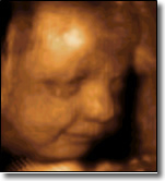 27 Week Fetus 3D Ultrasound