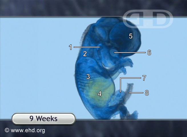 9-Week Fetus, MRI Animation [Click for next image]