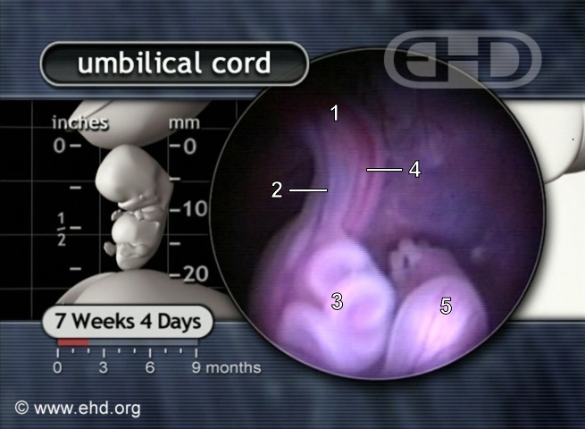 Base of Umbilical Cord, 7½ Weeks [Click for next image]