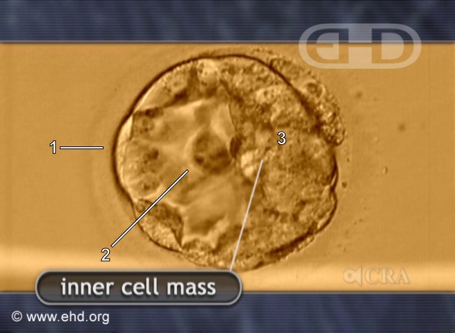 Blastocyst with Inner Cell Mass [Click for next image]