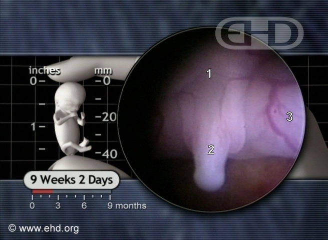 Genital Tubercle at 9 Weeks, 2 Days [Click for next image]