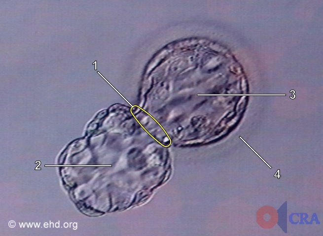 Hatching Blastocyst [Click for next image]