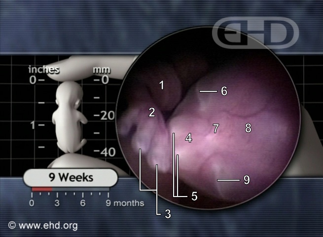The 9-Week Fetus [Click for next image]