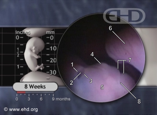 The Eye at 8 Weeks Pregnant [Click for next image]