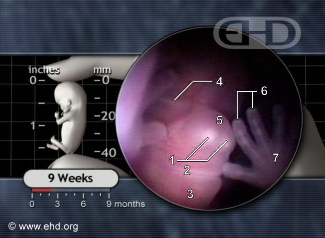 The Face at 9 Weeks [Click for next image]