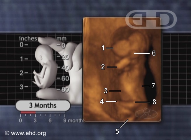 Three-Month Fetus [Click for next image]