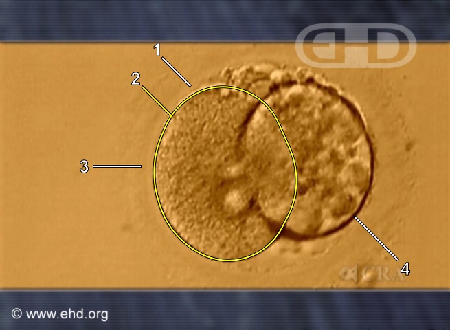 Two-Cell Human Embryo [Click for next image]