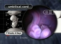 Base of Umbilical Cord, 7½ Weeks