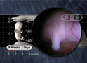 Genital Tubercle at 9 Weeks, 2 Days