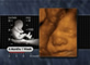 Face, 25-Week Fetus