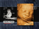 Face, 27-Week Fetus