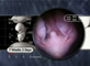 Lower Embryo at 7 Weeks, 2 Days