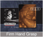 Play Movie - 8 to 9 month fetus, firm hand grasp