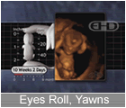 Play Movie - 10 to 11 week fetus, eyes roll, yawns