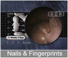 Play Movie - 11 to 12 week fetus, nails, fingerprints