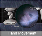 Play Movie - 6 to 7 week embryo, hand movement