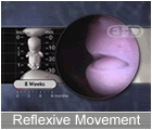 Play Movie - 8 to 9 week fetus, reflexive movement